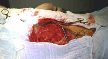 Redevet-tumor4