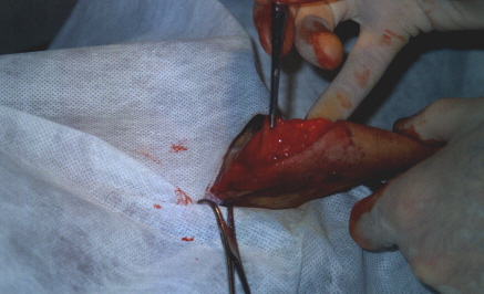 patela5